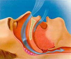 airflow during snoring